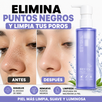 Aceite Limpiador SEYOUL - Elimina Puntos Negros y Sebo Sin Dolor