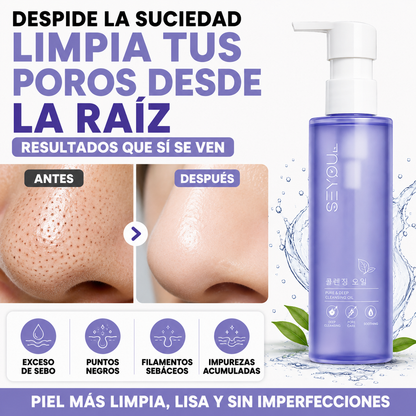 Aceite Limpiador SEYOUL - Elimina Puntos Negros y Sebo Sin Dolor